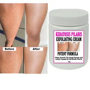 Powerful Whitening Repair Strawberry Legs Exfoliating Cream Potent Formula Effective Removal Of Pore Black Spots Whitening Cream