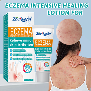 Ungüento para Psoriasis, Eccema, Alergias, Picazón, Salud de la Piel, Erupciones, Ungüento para Eccema para la Piel del Cuerpo - Product Image 3