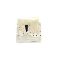Modèle dentaire transparent pour implant oral humain à usage médical avec couronne et pont, à des fins d'étude dentaire, CE/ISO