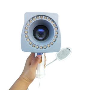 カーネルブランドKN-2200 LEDライトHDデジタルビデオコルポスコープ婦人科膣検査 - Product Image 6