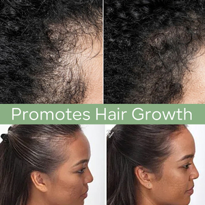 BUNEE cheveux croissance rapide sérum traitement amincissement des cheveux Anti perte <span class=keywords><strong>de</strong></span> cheveux prévenir la <span class=keywords><strong>calvitie</strong></span> cuir chevelu guérir nourrir des racines fortes huile d'essence - Product Image 6