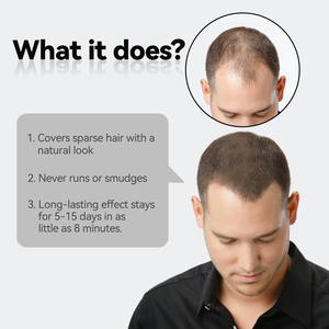 <span class=keywords><strong>Crema</strong></span> Calvicie 50ml, <span class=keywords><strong>Crema</strong></span> Correctora <span class=keywords><strong>de</strong></span> Calvicie, <span class=keywords><strong>Crema</strong></span> para Corregir la Calvicie, <span class=keywords><strong>Crema</strong></span> para Cubrir la Calvicie, <span class=keywords><strong>Crema</strong></span> para Engrosar el <span class=keywords><strong>Cabello</strong></span> - Product Image 2