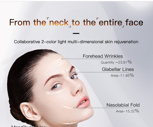 OEM Điện Cổ nâng thiết bị Da Thắt chặt máy mới có thể sạc lại ấm mặt nhăn Remover Công cụ ABS rung - Product Image 6