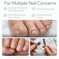 Sérum de soin des ongles à l'huile d'arbre à thé, marque privée OEM, pour le renouvellement des cuticules, le renforcement des ongles des pieds et des mains