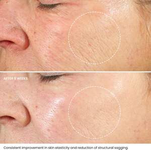 Suero Facial de Alta Calidad con Células Madre de Manzana Hidratante y Glutatión, 30 ml, Aclara el Tono de la Piel, Cuidado Facial Líquido - Product Image 3