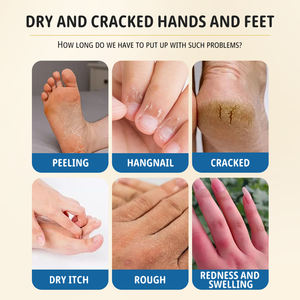 Una crema lenitiva che allevia la pelle secca e screpolata di mani e piedi, e fornisce sollievo dal gonfiore e idratazione - Product Image 2