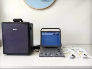 Ecógrafo Veterinario Portátil Sonoscape S8expV, Ecocardiografía, Ecógrafo Doppler Color 3D 4D con 2 Sondas - Product Image 3