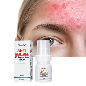 Sérum facial léger Soulagement des rougeurs Sérum Spray Toner <span class=keywords><strong>Anti</strong></span>-Rougeurs Calmant <span class=keywords><strong>Visage</strong></span> Sérum Bikini Pour Peau Sensible - Product Image 1