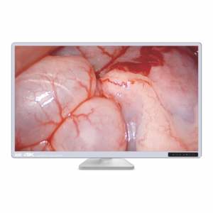 Máquina De Endoscopia Médica 32 Polegadas Veterinária Endoscópio Câmera Endoscopia Configuração Do Sistema Gastroscópio e Colonoscópio - Product Image 2