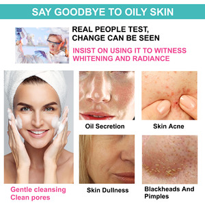 Savon Solide Artisanal Hydratant Nettoyant Exfoliant Éclaircissant pour la Peau au Kojic - Product Image 2