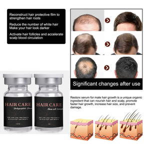 Suero para el Crecimiento del Cabello G, Kit para el Crecimiento de la Barba, Tratamiento para el Recrecimiento del Cabello para un Cabello Más Grueso y Abundante, Detiene la Caída del Cabello en el Cuero Cabelludo para Hombres y Mujeres - Product Image 4