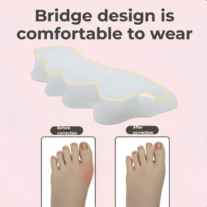 Separadores de Dedos Pequeños para Adultos y Niños, Dispositivo Ortopédico para Aliviar el Dolor de Pies y Enderezar la Deformidad del Hallux, Venta Directa de Fábrica - Product Image 3