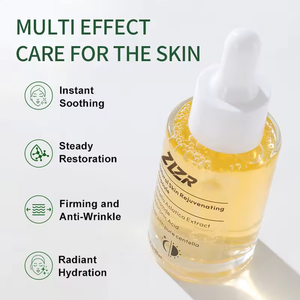Suero Facial Personalizado con Centella Asiática y Aloe Vera, Hidratante, Reparador, Blanqueador, Minimizador de Poros, Antiarrugas y para el Acné - Product Image 4