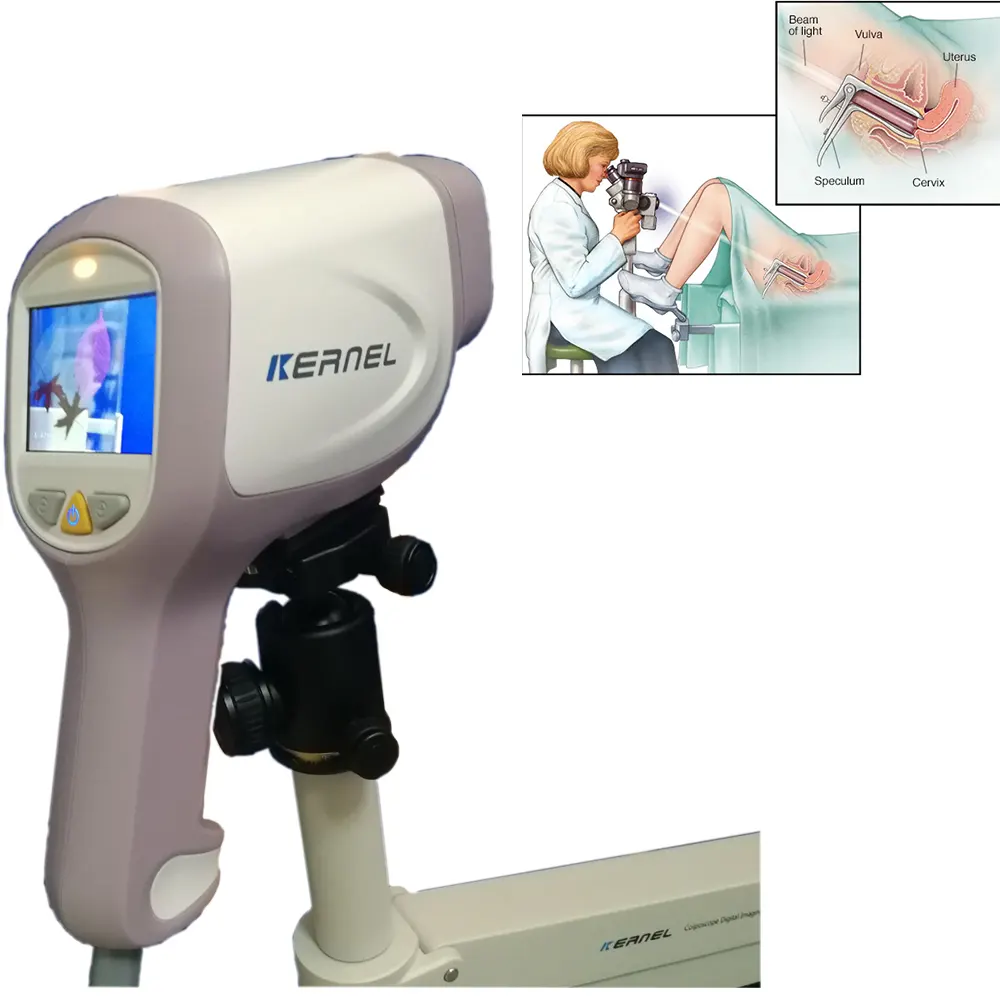 Super HD Portable Digital Colposcope Camera With Video For Gynecology 3.27MP pixels multifunction software