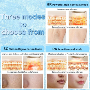 Appareil d'épilation permanente rapide à flash, 9 niveaux d'énergie, épilation indolore, épilateur pour femmes, <span class=keywords><strong>visage</strong></span> et corps, fabricant OEM ODM - Product Image 5