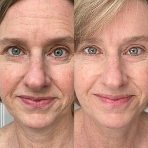 OEM/ODM NAD+ Supplement High Quality Resveratrol Oral Liquid Drink Low-Sugar Natural Support Skin Whitening <b>Wrinkle</b> <b>Removal</b> for - Product Image 2