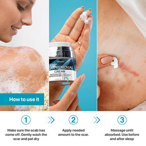 Removedor de cicatrices de acné de etiqueta privada Anti Vergeture Repair Productos de eliminación de cicatrices Crema de eliminación de cicatrices de acné fuerte y efectiva - Product Image 3