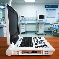 Appareil d'échographie portable numérique noir et blanc multifonctionnel pour le diagnostic en milieu hospitalier/clinique