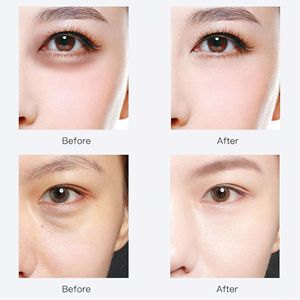 Patchs pour les yeux en collagène et acide hyaluronique OEM/ODM, anti-âge, 30 paires, patchs en gel bleus pour les cernes, les poches et les rides - Product Image 5