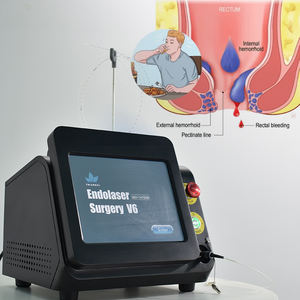 Draagbare 980nm 1470nm <span class=keywords><strong>laser</strong></span> voor hemorroïdenchirurgie, minimaal invasieve behandeling van hemorroïden, fistels, fissuren en sinus, 2026 model. - Product Image 4