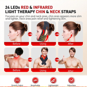 Terapia de luz roja para alivio en el hogar del dolor de cuello y fatiga, compresa caliente de luz roja para adelgazar el rostro y correa para la barbilla - Product Image 5