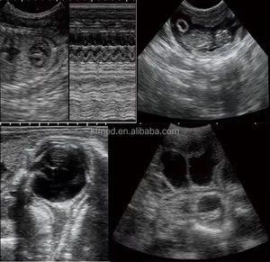 Mesin Ultrasound Instrumen Veteriner untuk USG Kehamilan Hewan dengan <span class=keywords><strong>Probe</strong></span> Linear / Convex Rektal - Product Image 5