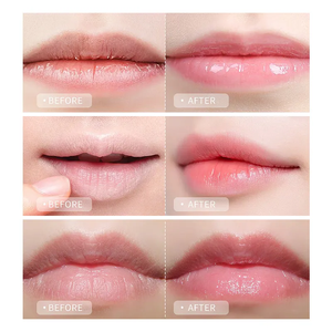 ลิปบาล์มให้ความชุ่มชื้นชุดบาล์มรักษาริมฝีปากครีมกันแดด SPF 15ฉลากส่วนตัว - Product Image 5