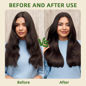 OEM personalizado a granel 100% pura menta orgánica natural esencial biotina y ricino fenogreco aceite de Romero para el crecimiento del cabello - Product Image 6