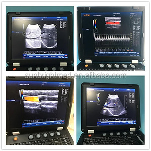 CE - Mejor Precio - Ecógrafo Portátil para Clínica/Hospital, <span class=keywords><strong>Doppler</strong></span> Color 3D, Dispositivos de Ultrasonido <span class=keywords><strong>Doppler</strong></span> Portátiles - Product Image 4