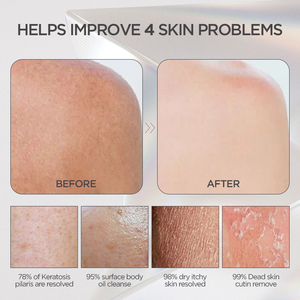 <span class=keywords><strong>Gants</strong></span> de douche épais doux gant exfoliant gant de gommage nettoyage en profondeur gommage corporel <span class=keywords><strong>gants</strong></span> exfoliants uniformisent la texture de la peau - Product Image 3