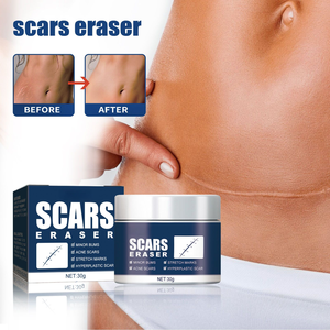 Nhãn Hiệu Riêng Hữu Cơ Kem Cơ Thể Cho Nhanh Chóng Cứu Trợ Và Sửa Chữa Các Vết Sẹo Cũ Hiệu Quả Trên Sẹo Vết Rạn Rạn Và Bỏng - Product Image 1