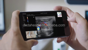 Échographe vétérinaire portable haut de gamme Mindray MX6, équipement médical à ultrasons Doppler couleur Mindray pour clinique vétérinaire - Product Image 5