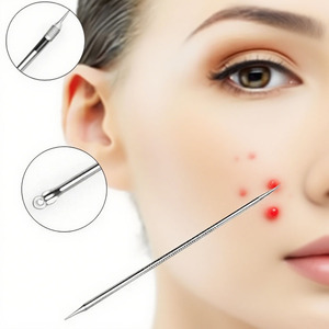 Профессиональный набор для удаления черных точек ODM 5 в 1 из нержавеющей стали: иглы для прыщей и акне, пинцет для белых и черных комедонов, экстрактор для удаления комедонов - Product Image 1