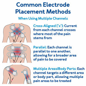 Appareil de thérapie TENS électrique à fréquence réglable de qualité médicale 10 ans, 4000 Hz RUSS IFT, pour soulager la douleur et la récupération musculaire - Product Image 5