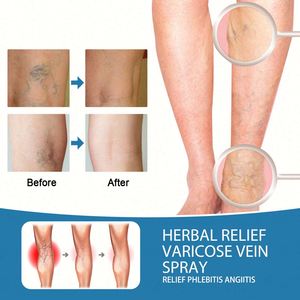 Спрей для ухода за ногами, 30 мл - Product Image 6