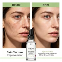 Essence faciale personnalisée à étiquette privée, sérum en gel à la vitamine B5, produit de soin de la peau OEM avec emballage personnalisé