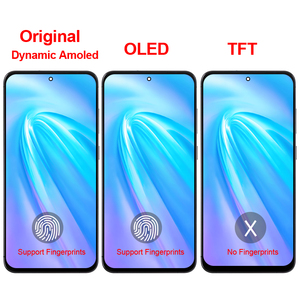 Pannello TFT Dynamic Amoled S24+ Originale, Schermo Touch OLED di Ricambio, Display LCD S24 Plus con Cornice per <span class=keywords><strong>Samsung</strong></span> <span class=keywords><strong>Galaxy</strong></span> S926 B/<span class=keywords><strong>E</strong></span>/W - Product Image 3