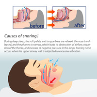 Nasal Clean Wash Rhinite Sinusite chronique Spray nasal Anti-ronflement Spray Soulagement du ronflement Liquide Outils de soin du nez