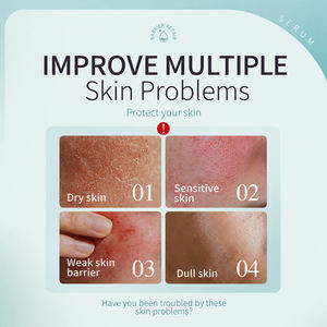 Crema Facial OEM con Ceramida y Niacinamida, Repara la Barrera Cutánea, Hidrata, Calma el Enrojecimiento, para Piel Sensible, Marca Privada, Venta al Por Mayor - Product Image 3