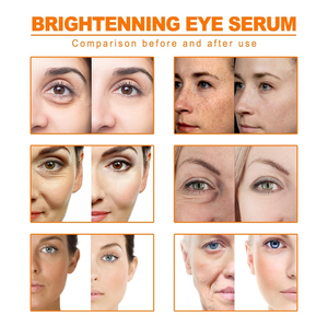 Sérum <span class=keywords><strong>Visage</strong></span> <span class=keywords><strong>Anti</strong></span>-Taches Brunes à l'<span class=keywords><strong>Huile</strong></span> <span class=keywords><strong>Essentielle</strong></span> de Curcuma, <span class=keywords><strong>Anti</strong></span>-Rides, Thérapeutique Contre l'Acné, Resserre les Pores, Blanchissant et Hydratant, Soin de la Peau - Product Image 5