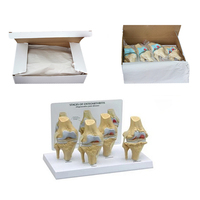 PVC Simulation Médicale Squelette Modèle Pathologie Humaine Genou Modèle D'anatomie