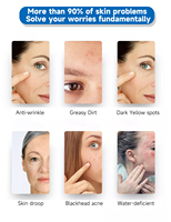 Appareil de microdermabrasion Hydra Peel, hydrodermabrasion, machine faciale, technologie de jet d'oxygène, dermabrasion, fonctions hydratantes CN