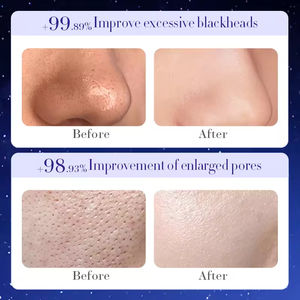 OEM美容製品 緑茶 黒ずみ除去 ディープクレンジング オイルコントロール 鼻用フェイスマスク 竹炭ピーリング ブラッククレイマスク - Product Image 3