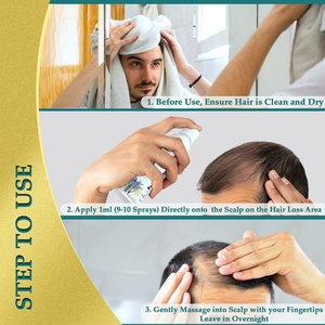 Spray para el Crecimiento del Cabello con Logotipo Personalizado OEM, Cuidado Capilar Orgánico, Aumenta el Grosor, Mejora la Salud del Cuero Cabelludo - Product Image 5