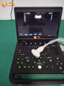 Mesin USG Digital Portabel SUN-800C untuk Kehamilan, Rumah Sakit, dan Ekokardiografi - Product Image 2