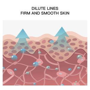 Biosphere Wholesale – Crème Réparatrice Anti-Vergetures et Cicatrices d'Acné pour Ventre, Fesses et Abdomen, Élimine les Marques de Croissance et les Rides - Product Image 5