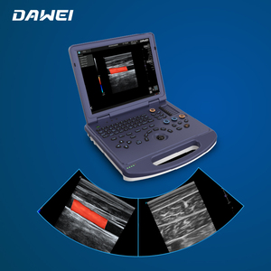 Sistema <span class=keywords><strong>de</strong></span> Ultrasonido Doppler Color Portátil Tipo Laptop Totalmente Digital DW-L3i con Imágenes 3D <span class=keywords><strong>de</strong></span> <span class=keywords><strong>Brazo</strong></span> Libre - Product Image 2
