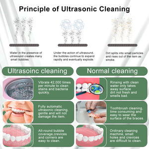 Pulitore Ultrasuoni Professionale per Apparecchi Ortodontici e Dentiere 24W 43KHz Mini Portatile per Uso Domestico - Product Image 5