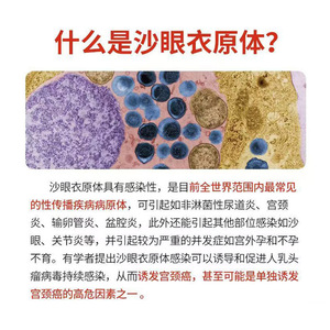 ชุดตรวจหาแอนติเจนคลามีเดีย Avicon สำหรับการตรวจหาโรคติดต่อทางเพศสัมพันธ์, แผ่นทดสอบสำหรับตรวจหาคลามีเดีย, ใช้ในบ้าน - Product Image 4