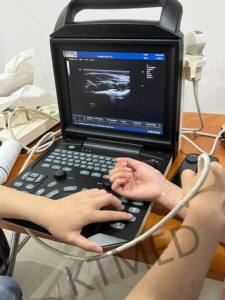 KT-A002 ज़ोनकेयर एम 5 3 डी 4 डी पोर्टेबल चिकित्सा अल्ट्रासोनिक इकोग्राफो पशु पशु पशु पशु चिकित्सा रंग डॉपलर अल्ट्रासाउंड प्रणाली - Product Image 5